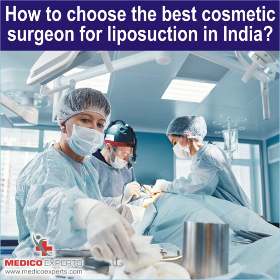 How to choose the best cosmetic surgeon for liposuction in India 1 best cosmetic surgeon for liposuction