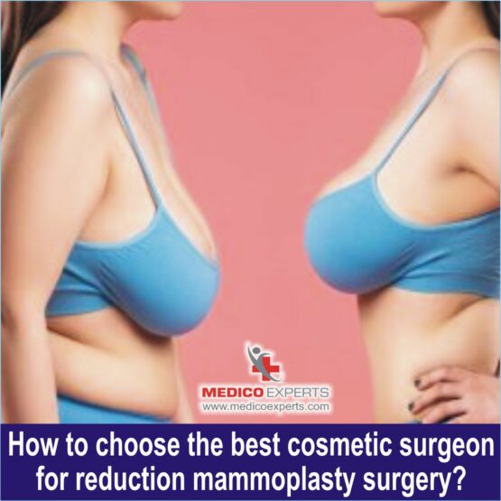 best cosmetics surgeon for breast reduction