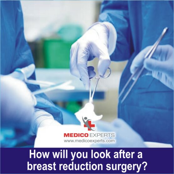 How will you look after a breast reduction surgery 1 Breast reduction surgery