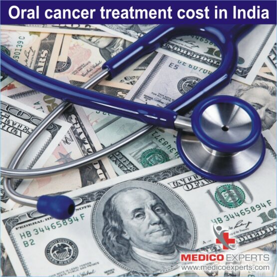 oral cancer treatment cost in India, cost of mouth cancer treatment in india