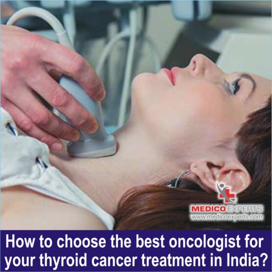 Best oncologist for thyroid cancer, survival rate of thyroid cancer