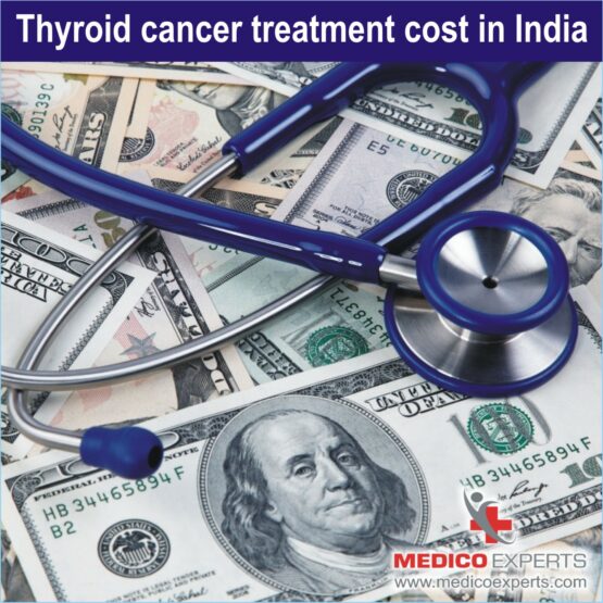 thyroid cancer treatment cost, thyroid cancer treatment cost in india, thyroid surgery cost in india