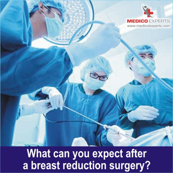 What can you expect after a breast reduction surgery 1 breast reduction surgery in India
