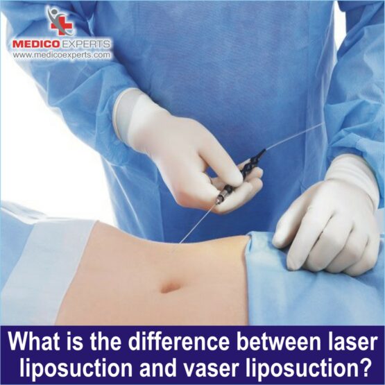 laser liposuction vs vaser liposuction