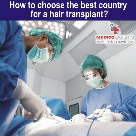 best country for hair transplant, hair transplant before and after