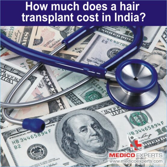 hair transplant cost india