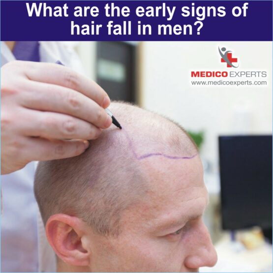 early signs for hair fall hair transplant side effects, best hair transplant in india, hair rejuvenation clinic