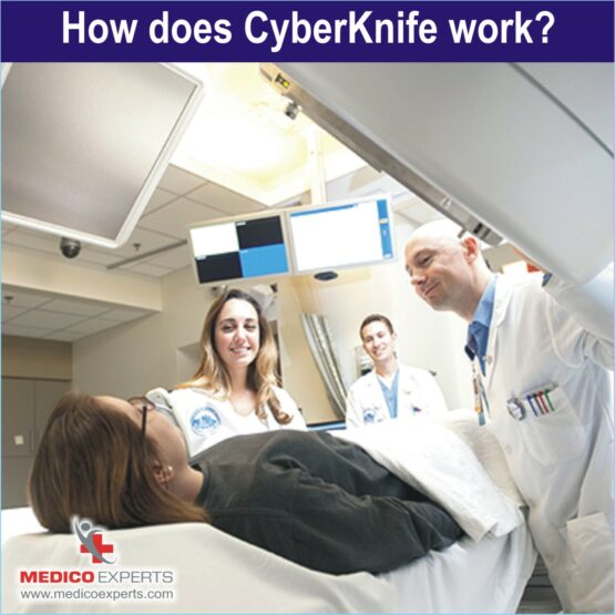 Cyberknife Treatment, cyberknife in india