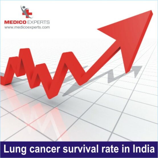 lung cancer survival rate in india, lung cancer survival rate
