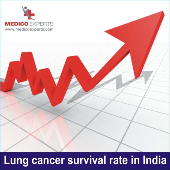 Lung Cancer survival rate in India lung cancer survival rate in india, lung cancer survival rate