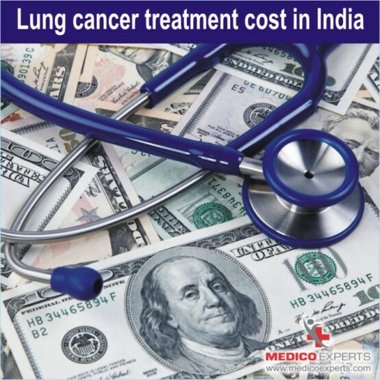 lung cancer treatment cost in India, cost of lung cancer treatment in india