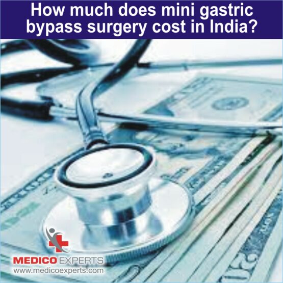 cost for Mini gastric Bypass Surgery
