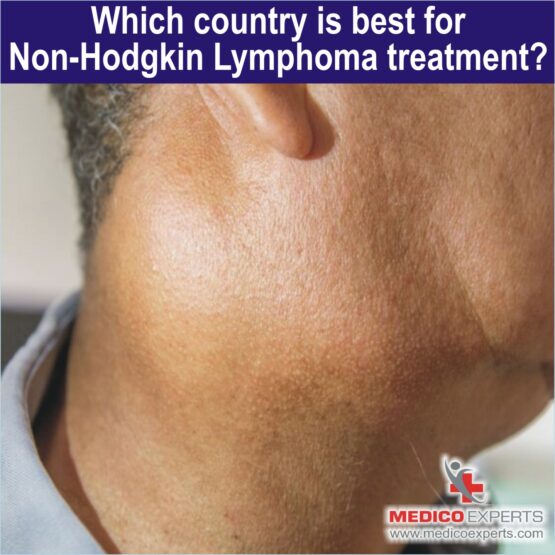Best country for Non-Hodgkin Lymphoma, non hodgkin's lymphoma treatment in india