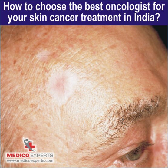 best oncologist for skin cancer treatment