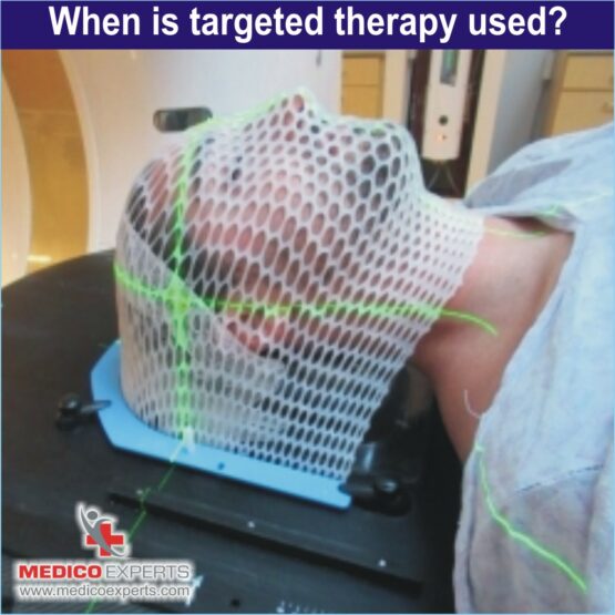 targeted therapy