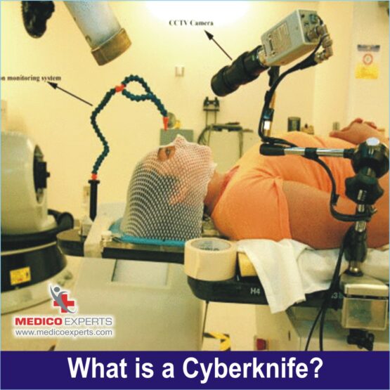 CyberKnife treatment in India, cyberknife treatment