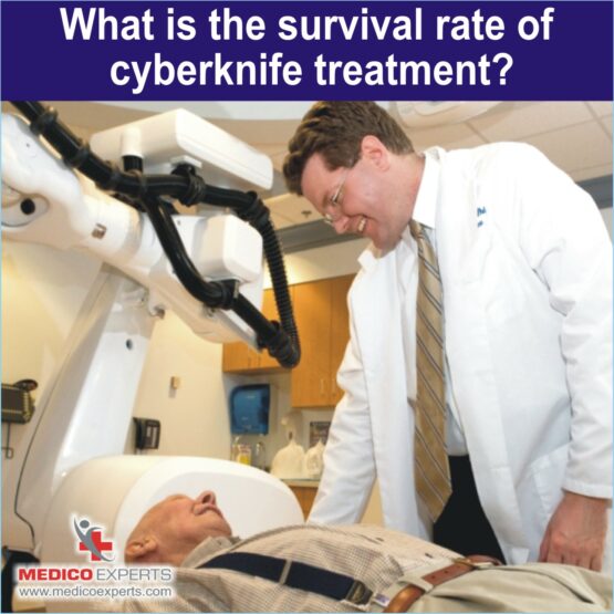 survival rate of Cyberknife Treatment