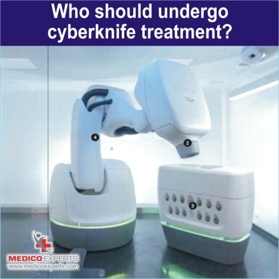 Cyberknife Treatment, cyberknife treatment in india