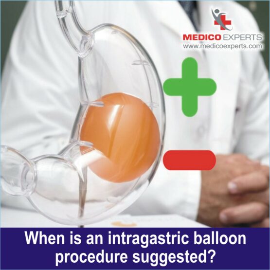 gastric balloon surgery