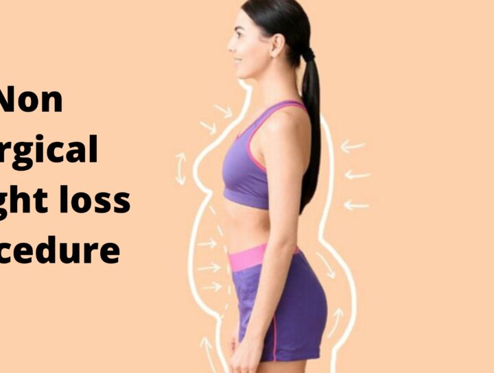 non surgical weight loss procedures