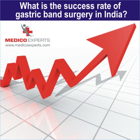 success rate of gastric banding surgery
