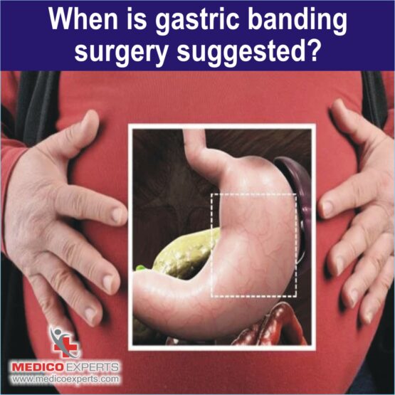 gastric banding surgery, gastric band procedure