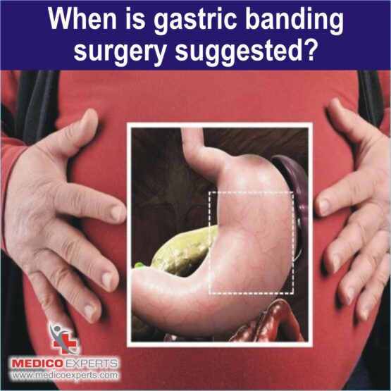 gastric banding surgery gastric banding surgery, gastric band procedure