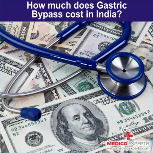 cost of gastric bypass surgery