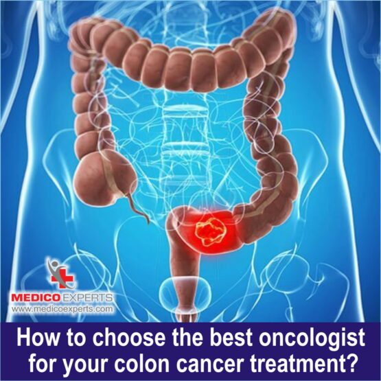 How to choose the best oncologist for your colon cancer treatment1