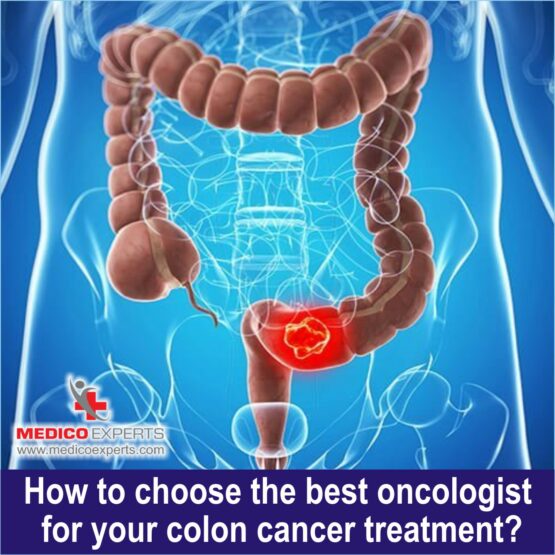 How to choose the best oncologist for your colon cancer treatment1 How to choose the best oncologist for your colon cancer treatment1
