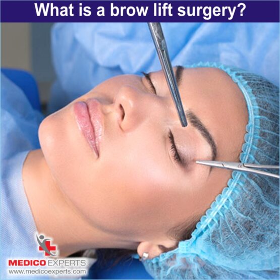 what is Browlift surgery