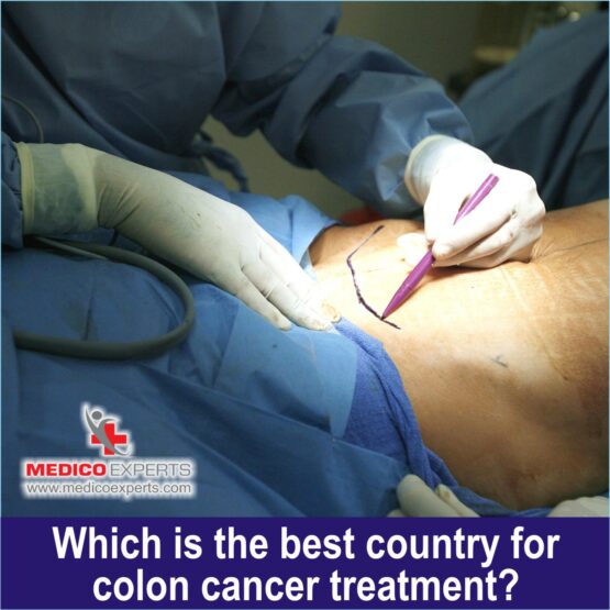 best country for colon cancer