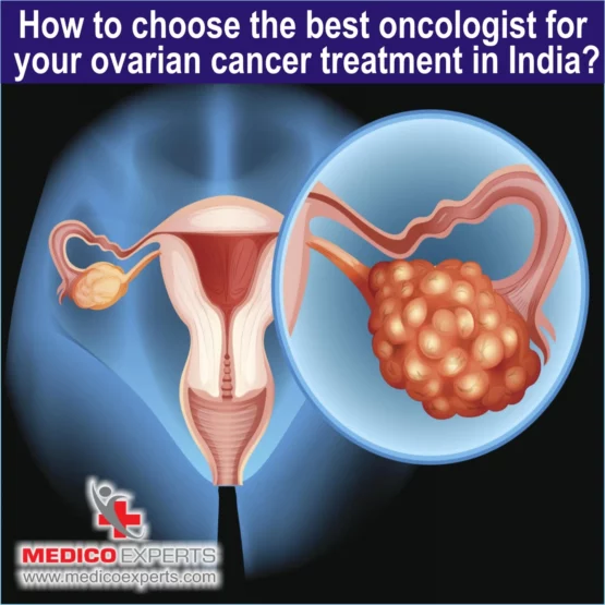 best doctors for ovarian cancer treatment in india, ovarian cancer treatment in india