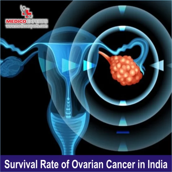 ovarian cancer survival rate in india