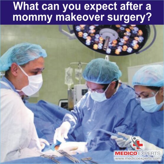 What can you expect after a mommy makeover surgery What can you expect after a mommy makeover surgery
