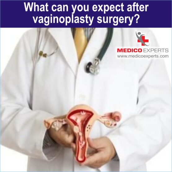 What can you expect after vaginoplasty surgery 1_11zon Vaginoplasty in India