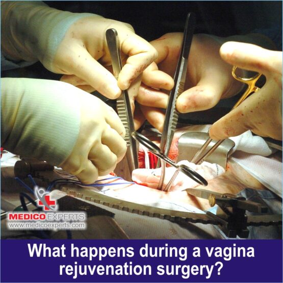 What happens during a vagina rejuvenation surgery 1_11zon Vaginoplasty in India