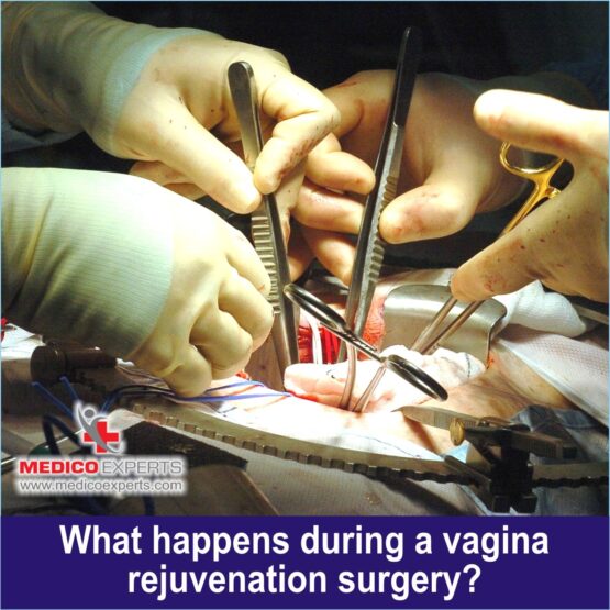 Vaginoplasty in India