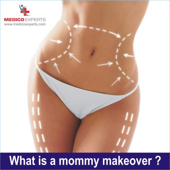 What is a mommy makeover