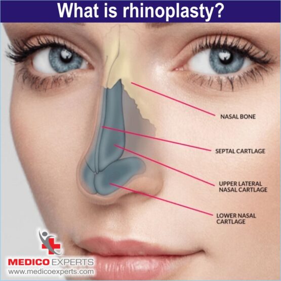 Rhinoplasty Surgery, best rhinoplasty surgery in india