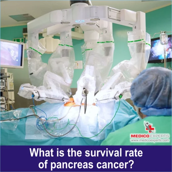What is the survival rate of pancreas cancer, pancreatic cancer survival rate in India
