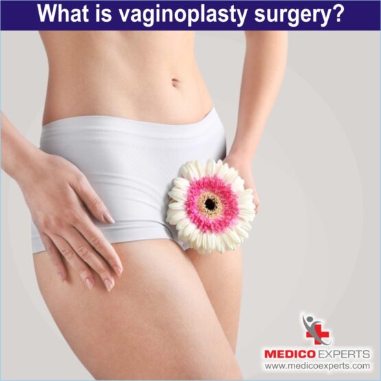 vaginoplasty surgery, vaginoplasty surgery