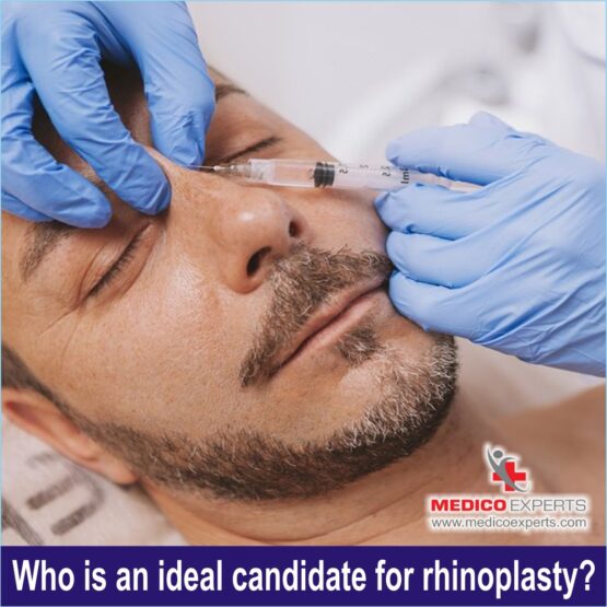 Who is an ideal candidate for rhinoplasty1_11zo Rhinoplasty Surgery, rhinoplasty surgery in india