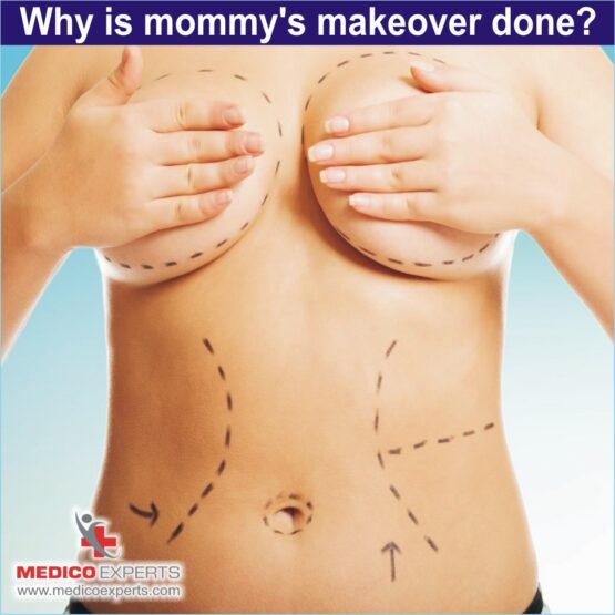 Why is mommy's makeover done Why is mommy's makeover done
