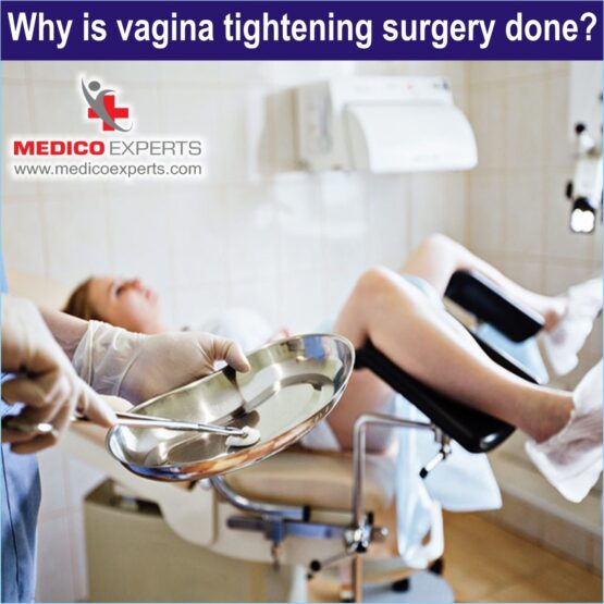 Vaginoplasty in India