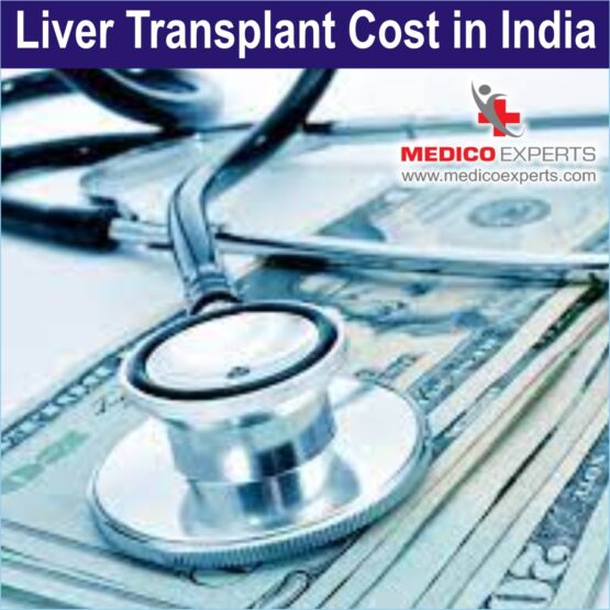 liver transplant cost in India