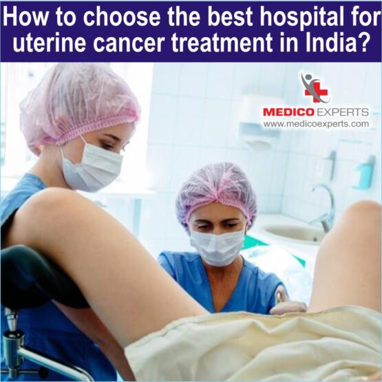 best hospital for uterine cancer treatment