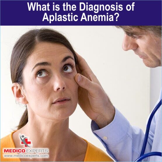 aplastic anemia treatment in india What is the diagnosis of Aplastic Anemia?