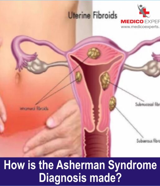 diagnostic tests that help in diagnosing Asherman syndrome