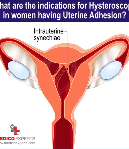 indications for hysteroscopy in women having Uterine adhesion